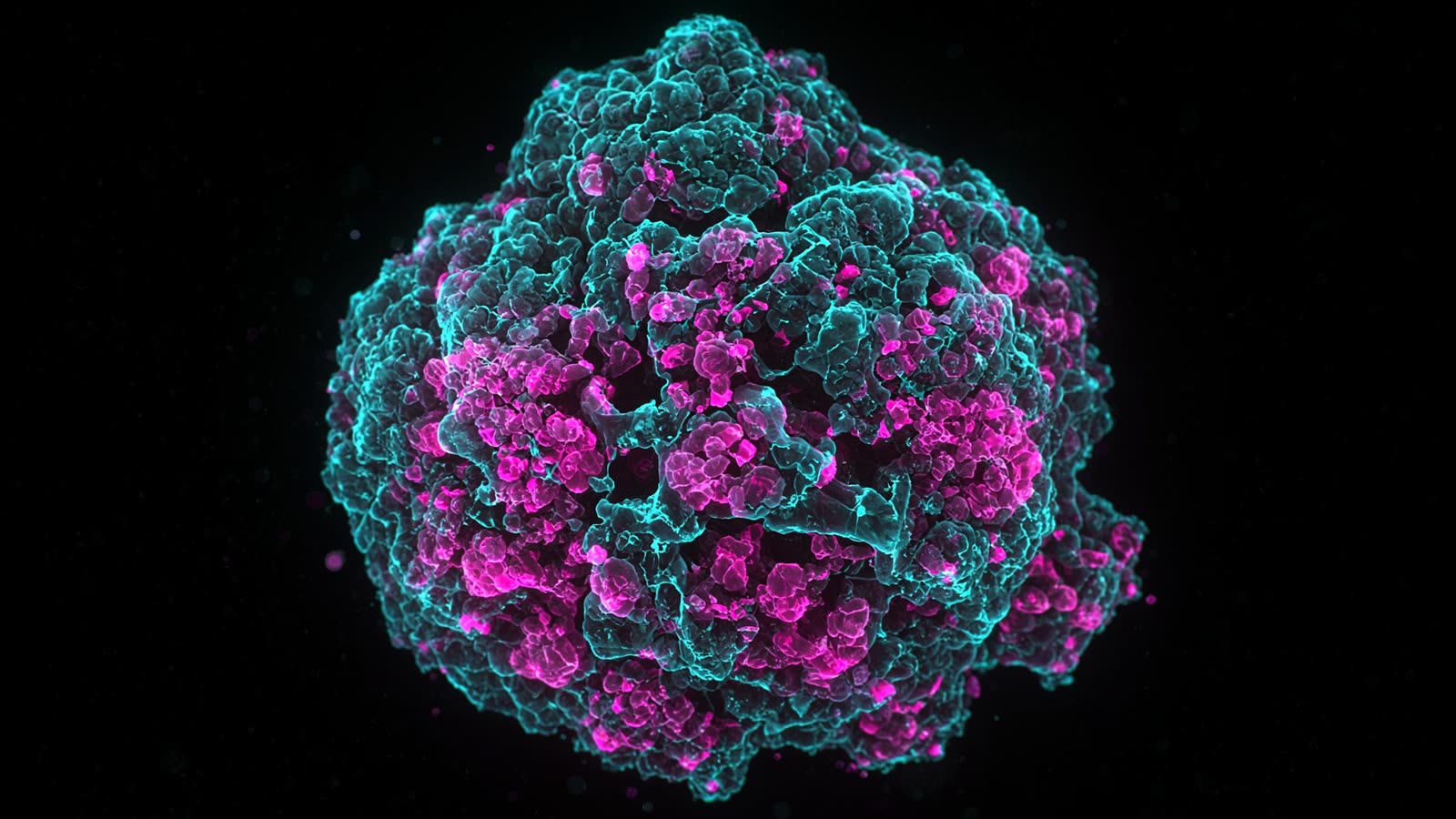 Fluorescence microscopy of a tumor organoid in teal and magenta channels
